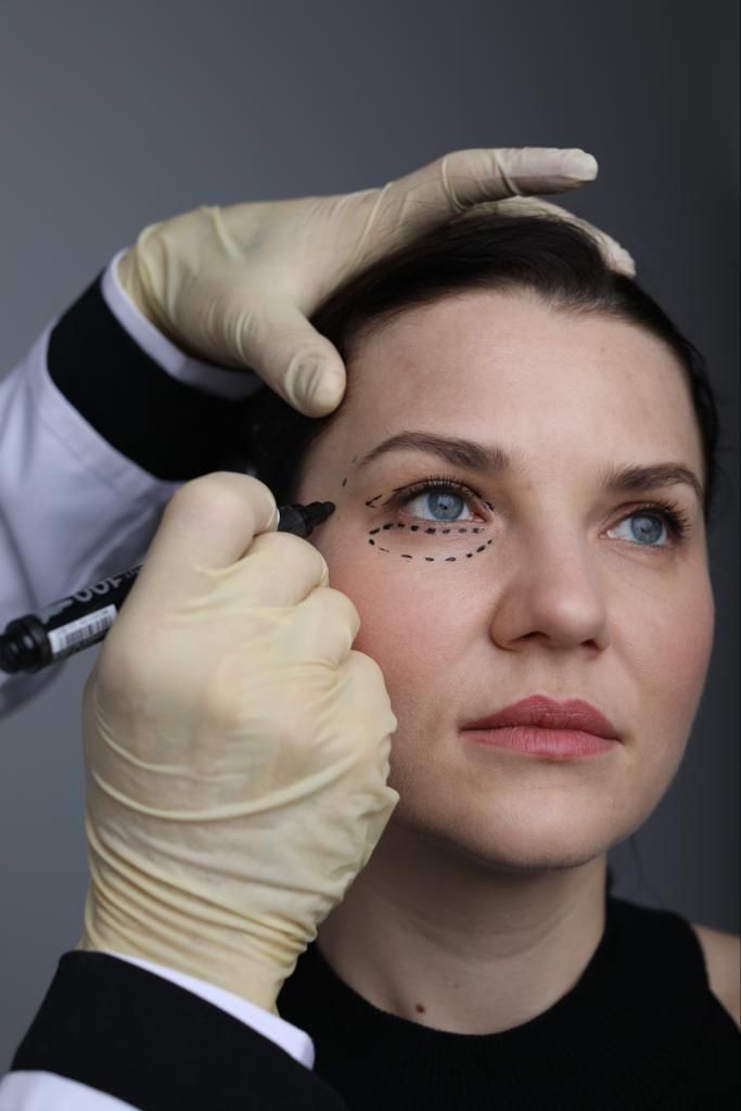 Chirurgie Du Visage